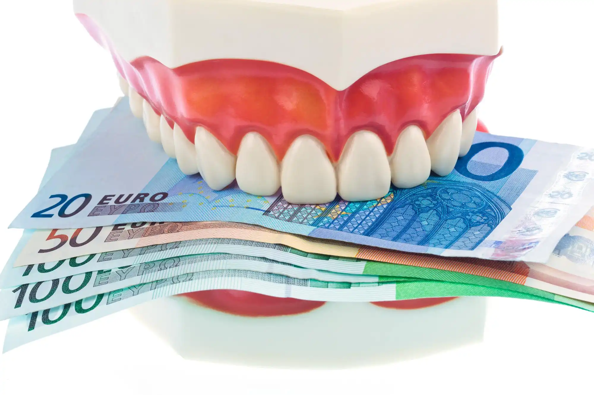 Zahnersatz-Modell mit kuenstlichen Zähnen – Symbol für Zahnzusatzversicherung und Kostenabsicherung beim Zahnarzt in Muenchen.